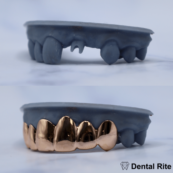 5 of Dental Rite image：